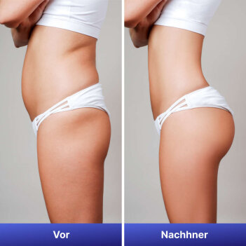 NavaMax image